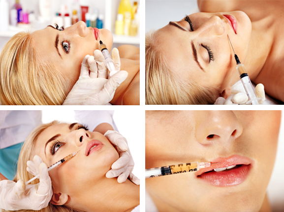 Ρυτίδες χειλέων